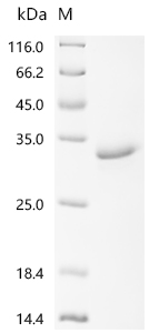 Recombinant Human Interleukin-20 receptor subunit beta (IL20RB), partial