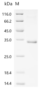 Recombinant Mouse Tumor necrosis factor receptor superfamily member 3 (Ltbr), partial