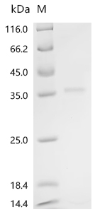 Recombinant Bovine Platelet-derived growth factor subunit B (PDGFB), partial