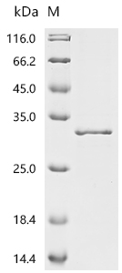 Recombinant Severe acute respiratory syndrome coronavirus 2 Nucleoprotein (N), partial