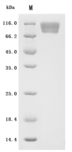 Recombinant Macaca fascicularis tyrosine-protein kinase Mer (MERTK), Partial (Active)