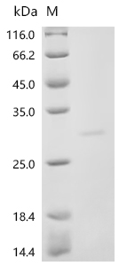 Recombinant Human Sodium-dependent phosphate transport protein 2B (SLC34A2), partial