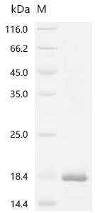 Recombinant Human C-C motif chemokine 5 (CCL5)