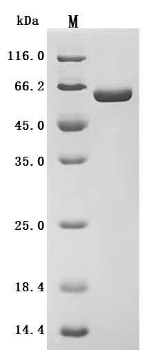 Recombinant Human Liver carboxylesterase 1 (CES1) (Active)