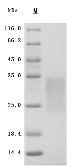 Recombinant Human/Cynomolgus monkey Activin receptor type-2B (ACVR2B), partial (Active)