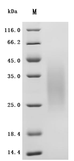 Recombinant Human B-cell antigen receptor complex-associated protein alpha chain (CD79A), partial (Active)