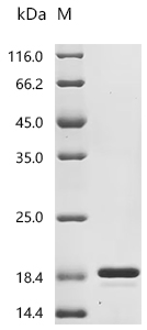 Recombinant Bovine Fibroblast growth factor 2 (FGF2) (Active)