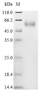 Recombinant Human Collagen alpha-1 (XV) chain (COL15A1), partial