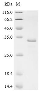 Recombinant Mycobacterium tuberculosis Protein grpE (grpE)