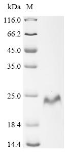 Recombinant Human Laminin subunit gamma-2 (LAMC2), partial