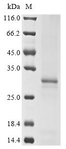 Recombinant Bat coronavirus 133/2005 Spike glycoprotein (S), partial