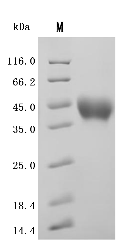 Recombinant Human Interleukin-15 receptor subunit alpha (IL15RA), partial (Active)
