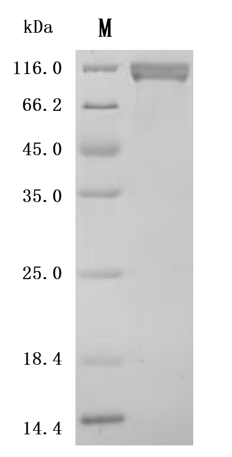 Recombinant Macaca fascicularis Inactive tyrosine-protein kinase 7 (PTK7), partial (Active)