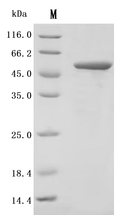Recombinant Finegoldia magna ATCC 53516 LPXTG-motif cell wall anchor domain protein, partial (Active)
