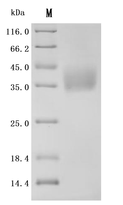 Recombinant Human CD276 antigen (CD276), partial (Active)