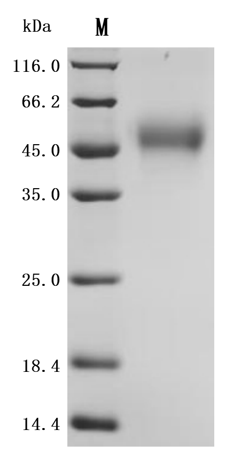 Recombinant Macaca mulatta Cytokine receptor common subunit gamma (IL2RG), partial (Active)