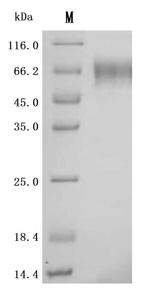 Recombinant Human Sialic acid-binding Ig-like lectin 9 (SIGLEC9), partial (Active)