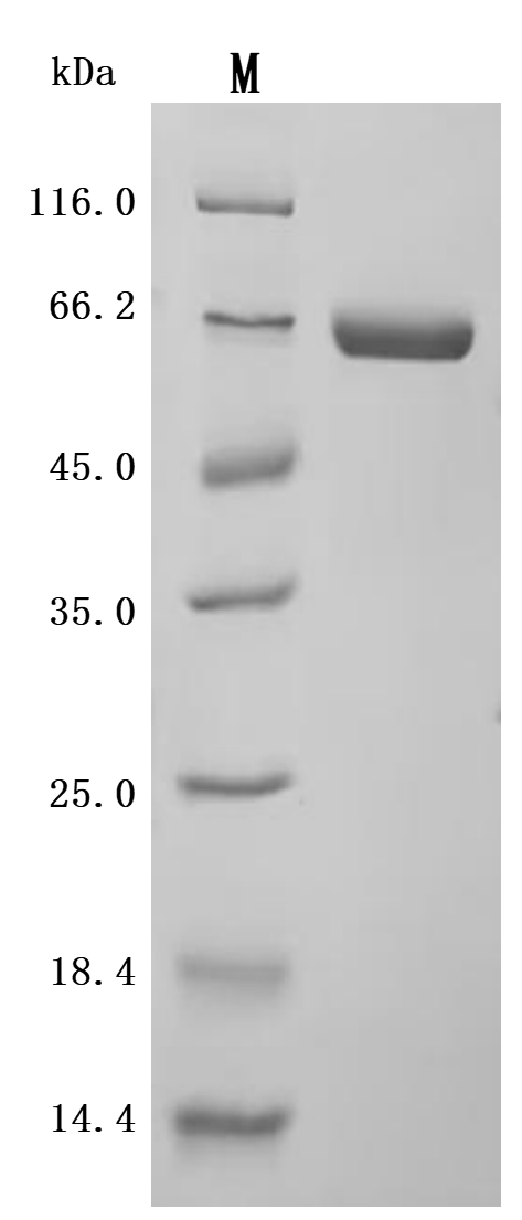 Recombinant Human Alkaline phosphatase, placental type (ALPP) (Active)