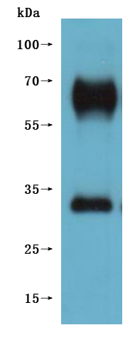 Recombinant Macaca fascicularis G-protein coupled receptor 20 (GPR20)-VLPs (Active)