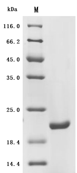 Recombinant Human Sodium-dependent phosphate transport protein 2B (SLC34A2), partial