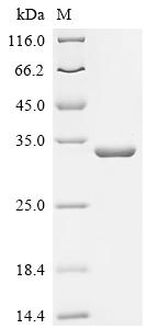 Recombinant Bacillus cereus Metallo-beta-lactamase type 2 (blm)