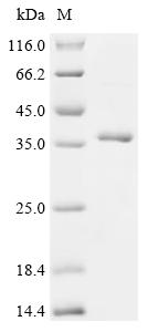 Recombinant Human C-C motif chemokine 20 (CCL20), partial