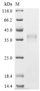 Recombinant Human Butyrophilin-like protein 9 (BTNL9), partial