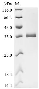 Recombinant Human Ubiquitin-conjugating enzyme E2 J1 (UBE2J1), partial