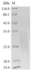 Recombinant Rat Parathyroid hormone/parathyroid hormone-related peptide receptor (Pth1r), partial (Active)