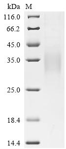 Recombinant Macaca fascicularis Glucagon-like peptide 1 receptor (GLP1R), partial (Active)