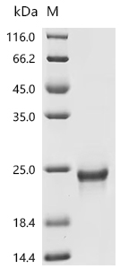 Recombinant Human Interferon alpha-2 (IFNA2) (Active)