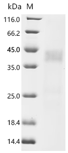 Recombinant Rat Asialoglycoprotein receptor 1 (Asgr1), partial (Active)