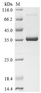 Recombinant Human Lymphocyte antigen 6E (LY6E) (Active)