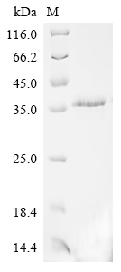 Recombinant Human B-lymphocyte antigen CD20(MS4A1)-Detergent (Active)