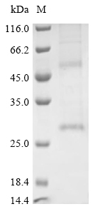 Recombinant Human Claudin-18.2 (CLDN18.2)-Detergent (Active)