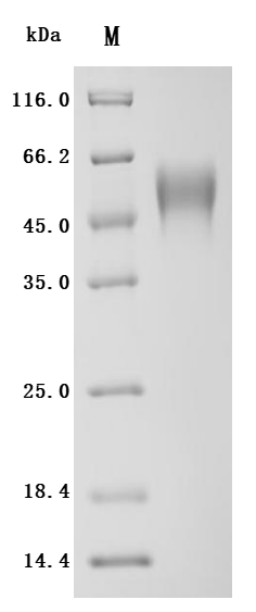 Recombinant Human Cytokine receptor common subunit gamma (IL2RG), partial (Active)