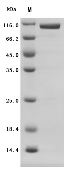 Recombinant Human Inactive tyrosine-protein kinase 7 (PTK7), partial (Active)