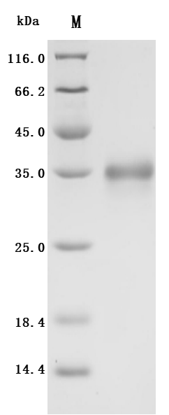 Recombinant Human Folate receptor alpha (FOLR1), partial (Active)