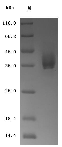 Recombinant Human Tissue factor (F3), partial (Active)