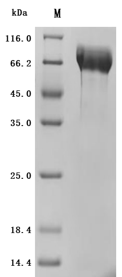 Recombinant Human Mucin-13 (MUC13), partial (Active)