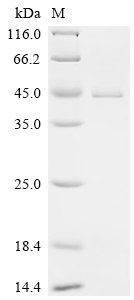Recombinant Human Ubiquitin-conjugating enzyme E2 J1 (UBE2J1), partial