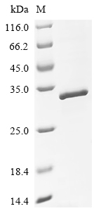 Recombinant Sheep Platelet-derived growth factor subunit B (PDGFB)