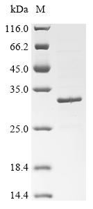 Recombinant Severe acute respiratory syndrome coronavirus 2 Spike glycoprotein (S) (L452R,T478K), partial