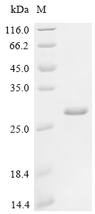 Recombinant Human Low affinity immunoglobulin gamma Fc region receptor III-B (FCGR3B)