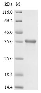 Recombinant Feline coronavirus Spike glycoprotein (S), Partial