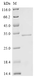 Recombinant Human Collagen alpha-1 (XXI) chain (COL21A1), Partial
