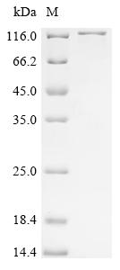 Recombinant Human Ubiquitin carboxyl-terminal hydrolase 43 (USP43)