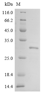 Recombinant Human Collagen alpha-1 (XI) chain (COL11A1), partial
