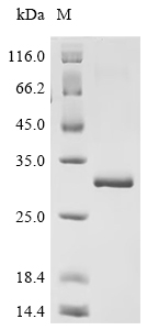 Recombinant Human Interleukin-12 subunit alpha (IL12A)