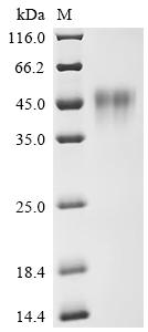 Recombinant Human Low affinity immunoglobulin gamma Fc region receptor III-A (FCGR3A) (F176V), partial